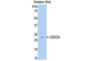 Western Blotting (WB) image for anti-Sulfite Oxidase (SUOX) (AA 89-270) antibody (ABIN1176602) (SUOX Antikörper  (AA 89-270))