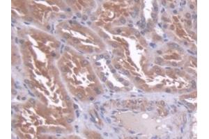 Immunohistochemistry (IHC) image for anti-Core-Binding Factor, beta Subunit (CBFB) (AA 1-182) antibody (ABIN7444154)