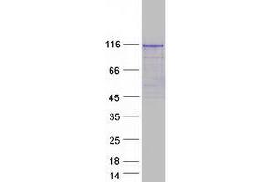 TUT1 Protein (Myc-DYKDDDDK Tag)