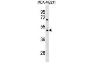 Western Blotting (WB) image for anti-Olfactory Receptor 1Q1 (OR1Q1) antibody (ABIN3000764) (OR1Q1 Antikörper)