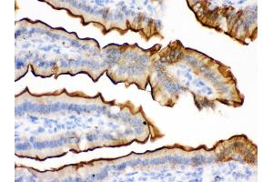 Anti- Villin Picoband antibody,IHC(P) IHC(P): Mouse Intestine Tissue