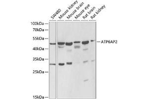 Western blot analysis of extracts of various cell lines, using  antibody (ABIN6129200, ABIN6137342, ABIN6137343 and ABIN6222191) at 1:1000 dilution. (ATP6AP2 Antikörper  (AA 251-350))
