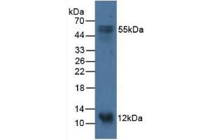 Figure. (S100A14 Antikörper  (AA 1-91))
