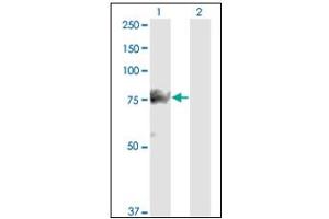 Western Blotting (WB) image for anti-SMAD Specific E3 Ubiquitin Protein Ligase 1 (SMURF1) antibody (ABIN781919) (SMURF1 Antikörper)