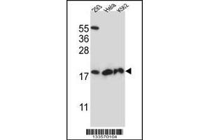 Western blot analysis in 293,Hela,K562 cell line lysates (35ug/lane). (DHFRL1 Antikörper  (AA 45-74))
