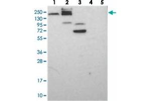 Western blot analysis of Lane 1: RT-4, Lane 2: U-251 MG, Lane 3: Human Plasma, Lane 4: Liver, Lane 5: Tonsil with GEMIN5 polyclonal antibody  at 1:250-1:500 dilution. (GEMIN5 Antikörper)