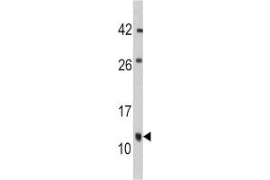 Western Blotting (WB) image for anti-FK506 Binding Protein 1B, 12.6 KDa (FKBP1B) antibody (ABIN3003540)