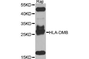 Western blot analysis of extracts of Raji cells, using HLA-DMB antibody.