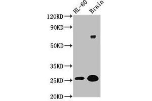 Western Blot Positive WB detected in: HL60 whole cell lysate, Rat brain tissue All lanes: FEV antibody at 5. (FEV Antikörper  (AA 1-97))