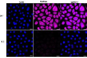 Immunocytochemical staining of HeLa cells using RAB4A antibody (ABIN7800097), 1:1,000), Top panel: wild-type (WT), Bottom panal: Adiponectin receptor 1 shRNA knockdown (KD).