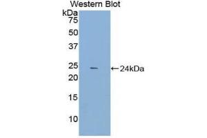 Western Blotting (WB) image for anti-Dynamin 1 (DNM1) (AA 572-745) antibody (ABIN1858658)