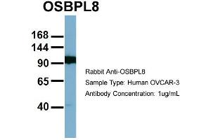 Host:  Rabbit  Target Name:  OSBPL8  Sample Type:  OVCAR-3  Antibody Dilution:  1. (OSBPL8 Antikörper  (Middle Region))