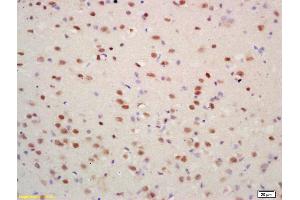 Immunohistochemistry (IHC) image for anti-Histone H4 (acLys17) antibody (ABIN1387532)