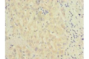 Immunohistochemistry of paraffin-embedded human liver tissue using ABIN7145347 at dilution of 1:100 (BEND7 Antikörper  (AA 1-374))