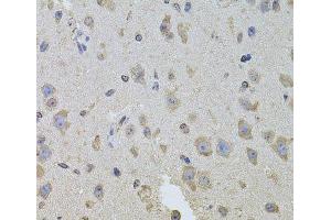 Immunohistochemistry of paraffin-embedded Mouse brain using ITGB8 Polyclonal Antibody at dilution of 1:100 (40x lens). (ITGB8 Antikörper)