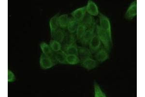 Detection of TUBb in Human MCF7 Cell using Polyclonal Antibody to Tubulin Beta (TUBb) (TUBB Antikörper  (AA 170-419))