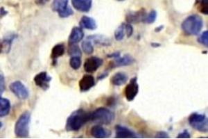 Immunohistochemistry analysis of paraffin-embedded rat lung using,CD63 (ABIN7073400) at dilution of 1: 750 (CD63 Antikörper)