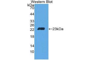 Western Blotting (WB) image for anti-CD6 (CD6) (AA 30-204) antibody (ABIN2118641) (CD6 Antikörper  (AA 30-204))