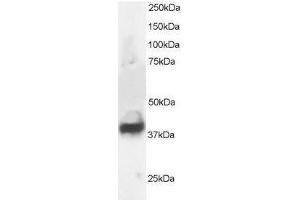 Image no. 1 for anti-Septin 3 (SEPT3) (N-Term) antibody (ABIN374202) (Septin 3 Antikörper  (N-Term))