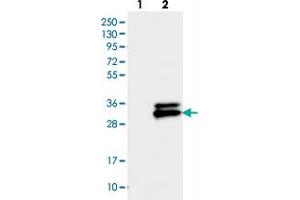 Western blot analysis of Lane 1: Negative control (vector only transfected HEK293T lysate), Lane 2: Over-expression Lysate (Co-expressed with a C-terminal myc-DDK tag (~3. (TMEM176A Antikörper)