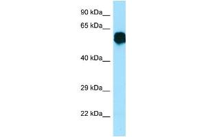 WB Suggested Anti-CR1L Antibody Titration: 1. (CR1L Antikörper  (Middle Region))