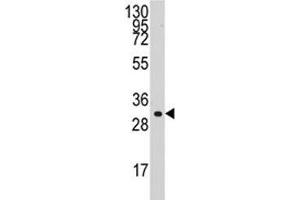 Western blot analysis of Cyclin C antibody and HL-60 lysate. (Cyclin C Antikörper  (AA 221-249))