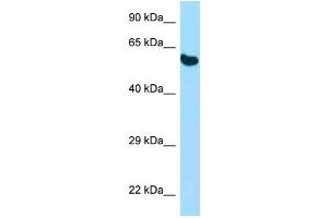 Western Blotting (WB) image for anti-Protein Disulfide Isomerase Family A, Member 3 (PDIA3) (N-Term) antibody (ABIN2789547) (PDIA3 Antikörper  (N-Term))