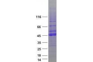 Western Blotting (WB) image for Transducer of ERBB2, 2 (TOB2) protein (Myc-DYKDDDDK Tag) (ABIN2733973)