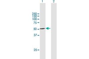 Western Blot analysis of PNPLA1 expression in transfected 293T cell line by PNPLA1 MaxPab polyclonal antibody.