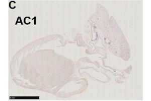 Immunohistochemistry of a left-sided rat heart for adenylyl cyclase AC1 (moderately positive) Source: PMID35625651 (ADCY1 Antikörper  (AA 751-850))