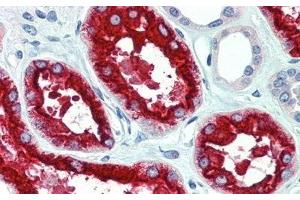 Detection of LRP2 in Human Kidney Tissue using Polyclonal Antibody to Low Density Lipoprotein Receptor Related Protein 2 (LRP2) (LRP2 Antikörper  (AA 4035-4184))