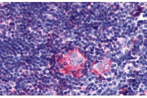 Anti-LPAR6 / P2RY5 antibody  ABIN1049020 IHC staining of human thymus. (LPAR6 Antikörper  (Extracellular Domain))