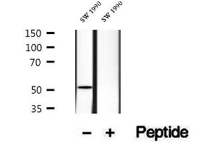 Western blot analysis of extracts of SW 1990 cells, using HERP antibody. (HERPUD1 Antikörper  (N-Term))
