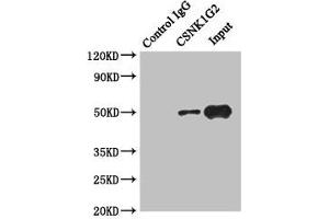 Casein Kinase 1 gamma 2 antibody  (Isoform gamma 2)