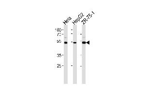 Western blot analysis in Hela,HepG2,ZR-75-1 cell line lysates (35ug/lane). (RAP1 Antikörper  (C-Term))