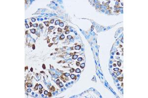 Immunohistochemistry of paraffin-embedded mouse testis using YB-1/YB-1/YBX1 antibody (ABIN6134494, ABIN6150328, ABIN6150330 and ABIN7101815) at dilution of 1:100 (40x lens). (YBX1 Antikörper  (AA 100-200))