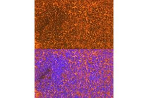 Immunofluorescence analysis of mouse spleen using CD83 Rabbit mAb (ABIN7266223) at dilution of 1:100 (40x lens). (CD83 Antikörper)