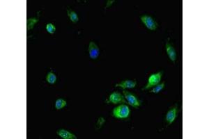 Immunofluorescent analysis of Hela cells using ABIN7161785 at dilution of 1:100 and Alexa Fluor 488-congugated AffiniPure Goat Anti-Rabbit IgG(H+L) (NFAT5 Antikörper  (AA 1422-1531))