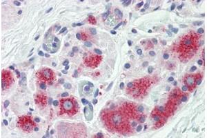 Human Prostate, Ganglion Cells: Formalin-Fixed, Paraffin-Embedded (FFPE) (PFDN1 Antikörper  (AA 1-50))