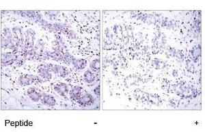 Image no. 1 for anti-Signal Transducer and Activator of Transcription 4 (STAT4) (Tyr693) antibody (ABIN197178) (STAT4 Antikörper  (Tyr693))