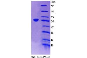 SDS-PAGE analysis of Human SSA1 Protein.