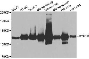 Western blot analysis of extracts of various cell lines, using MYO1C antibody (ABIN5974171) at 1/1000 dilution. (Myosin IC Antikörper)