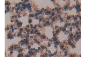Detection of CFH in Mouse Lung Tissue using Polyclonal Antibody to Complement Factor H (CFH)