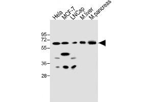 All lanes : Anti-CBS Antibody (Center) at 1:500 dilution Lane 1: Hela whole cell lysate Lane 2: MCF-7 whole cell lysate Lane 3: LNCap whole cell lysate Lane 4: mouse liver lysate Lane 5: mouse pancreas lysate Lysates/proteins at 20 μg per lane. (CBS Antikörper  (AA 301-330))