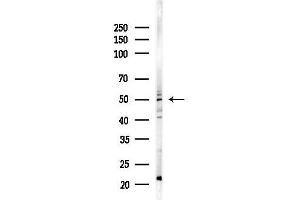 anti-Transducin (Beta)-Like 2 (TBL2) (C-Term) antibody