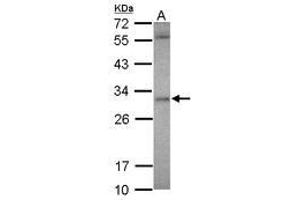Image no. 1 for anti-Ankyrin Repeat and SOCS Box-Containing 12 (ASB12) (AA 38-303) antibody (ABIN1496738) (ASB12 Antikörper  (AA 38-303))