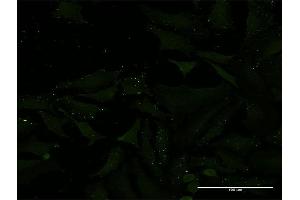 Immunofluorescence (IF) image for anti-ADAM Metallopeptidase with Thrombospondin Type 1 Motif, 1 (ADAMTS1) (AA 858-967) antibody (ABIN522992)