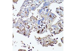 Immunohistochemistry of paraffin-embedded human placenta using Complement factor H Rabbit pAb (ABIN3023096, ABIN3023097, ABIN3023098 and ABIN6219387) at dilution of 1:100 (40x lens). (Complement Factor H Antikörper  (AA 20-270))