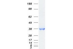 Western Blotting (WB) image for CD207 Molecule, Langerin (CD207) protein (Myc-DYKDDDDK Tag) (ABIN2713501)