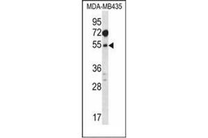 Western blot analysis of MAT1A Antibody (N-term) in MDA-MB435 cell line lysates (35ug/lane).
